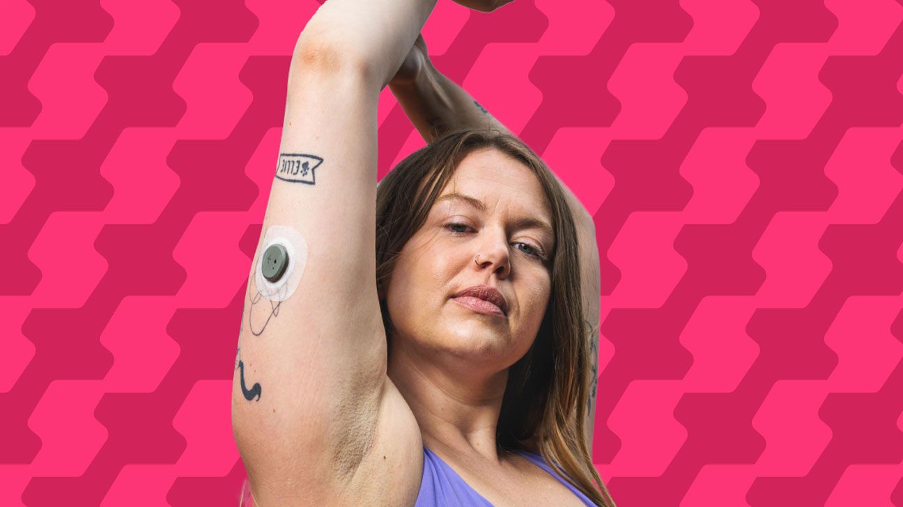 Signos glucose monitoring system pictured on the back of female's arm