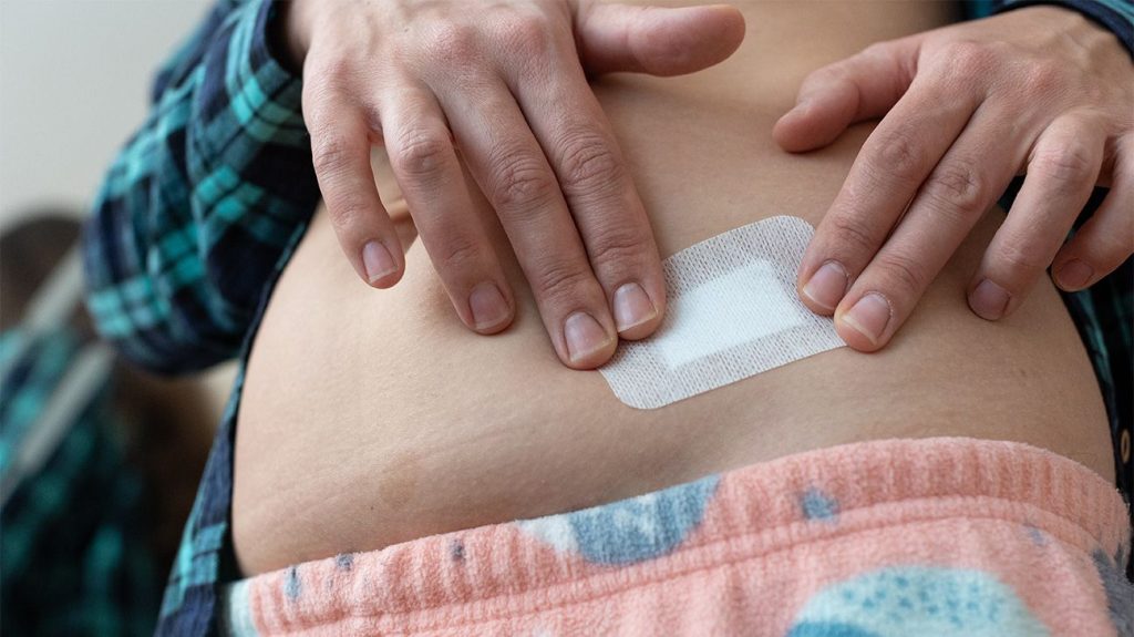 Person applying a hormone patch to their stomach